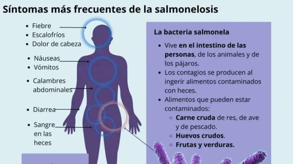 Síntomas de intoxicación alimentaria: ¿estás en riesgo? Identifícalos ya