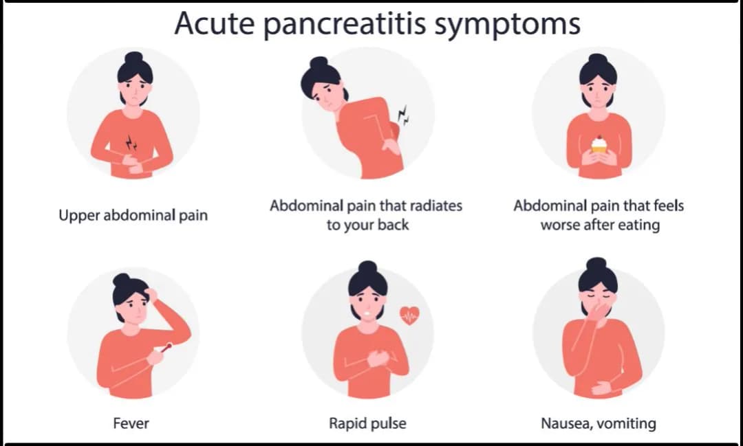 Síntomas pancreatitis leve: ¿Cómo reconocerlos y cuándo actuar?