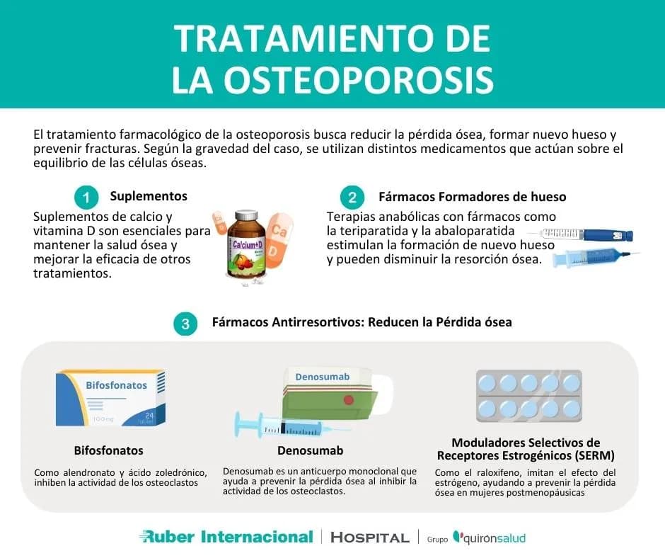 Medicamentos para la osteoporosis: opciones efectivas y riesgos a considerar